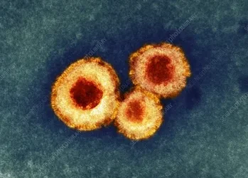 Meta-pneumo-virus: O nouă amenințare globală, cu cazuri confirmate și în Moldova: ANSP recomandă măsuri de prevenire