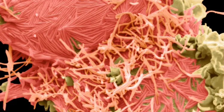 Infecțiile respiratorii cu HMPV în creștere global: Măsuri de protecție recomandate de ANSP