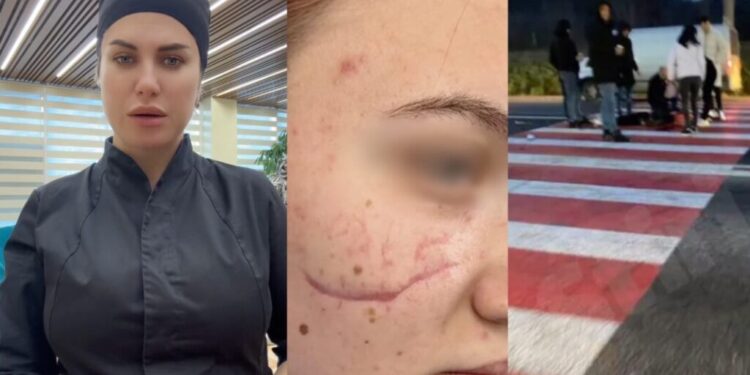 O adolescentă din Orhei beneficiază de o operație gratuită după un accident rutier