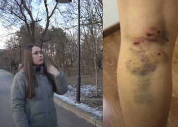 Femeie mușcată de câine vagabond în Parcul „Valea Trandafirilor” din Chișinău: