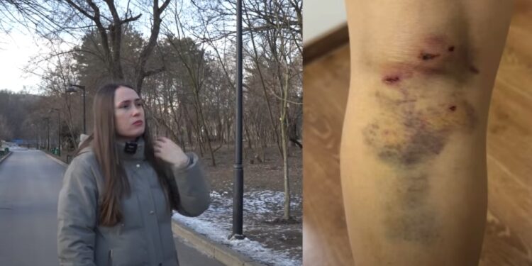 Femeie mușcată de câine vagabond în Parcul „Valea Trandafirilor” din Chișinău: