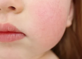 Învățătoare din Rîșcani acuzată de abuz fizic și verbal asupra unui elev autist