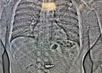 Jaythan Gilder, prins cu bijuterii furate în stomac, după un jaf la Tiffany & Co.