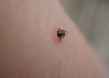 Aproape 250 de persoane s-au infectat cu Boala Lyme în 2024 din cauza mușcăturilor de căpușe
