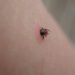 Aproape 250 de persoane s-au infectat cu Boala Lyme în 2024 din cauza mușcăturilor de căpușe